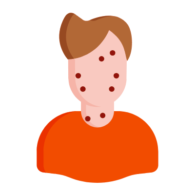 Acne, Animated Icon, Flat