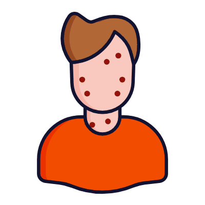Acne, Animated Icon, Lineal